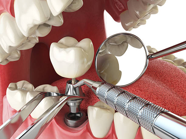 Best Emergency Treatment for Toothache in Noyack, NY